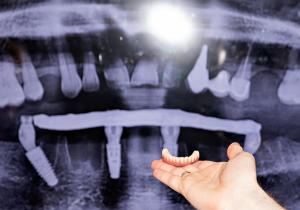 Фото Implant clinic, метро Ясенево Фото Implant clinic, метро Ясенево