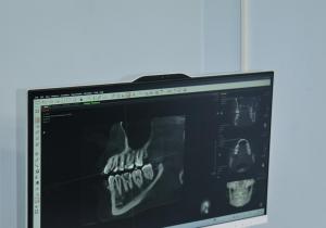 Фото Персона Dent