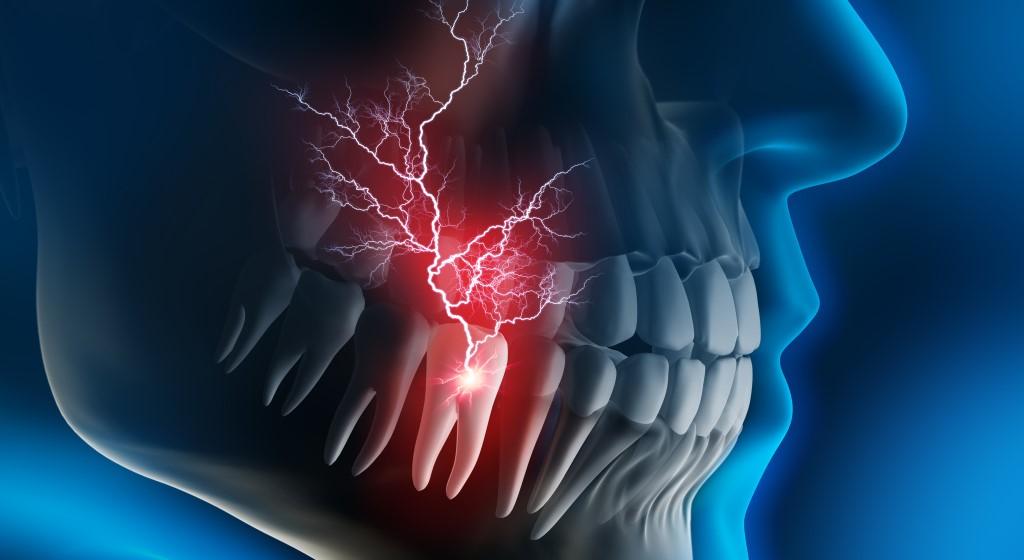 Пронизывающая зубная боль с распространением на щеку