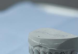 Фото Dentis by Dr. Markevich Фото Dentis by Dr. Markevich