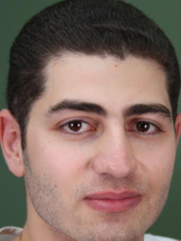 Хирург Мезиров Яннис Одиссеевич Хирург Мезиров Яннис Одиссеевич