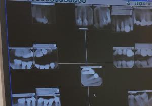 Фото US Dental Care Фото US Dental Care